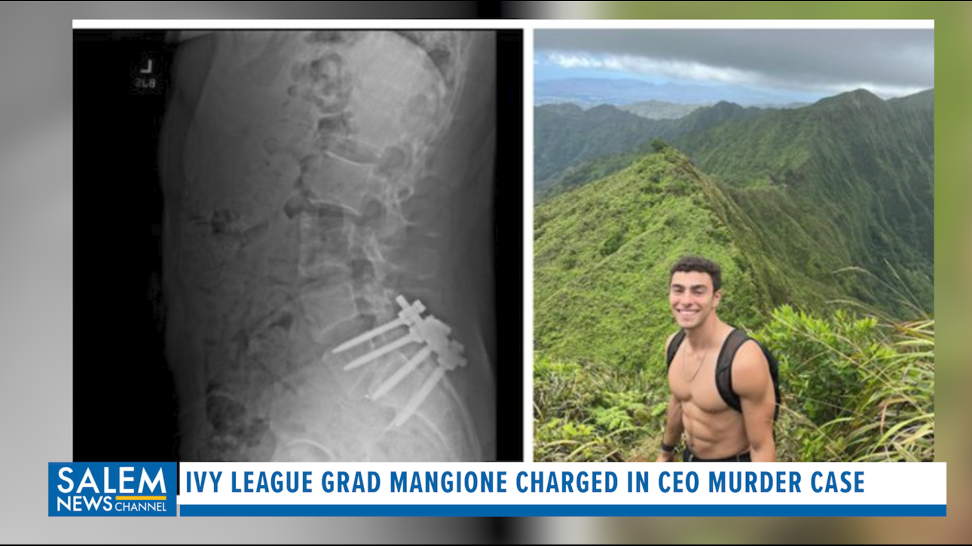 Luigi Mangione had back condition that made physical relationships ‘not possible’